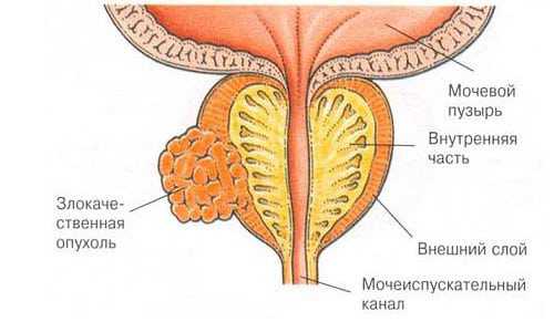 Благоприятным считается заболевание с оценкой